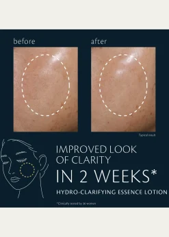 Cle de Peau BeauteHydro-Clarifying Essence Lotion, 5.7 oz.